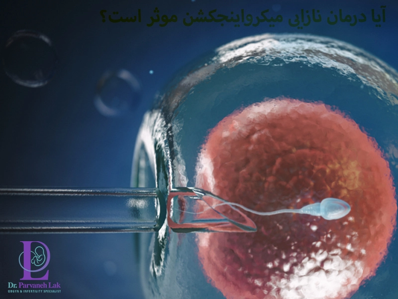 آیا درمان نازایی میکرواینجکشن موثر است؟