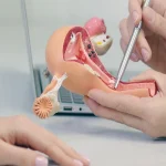 لاپاراسکوپی