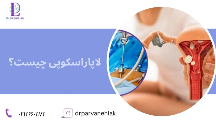 لاپاراسکوپی چیست؟ 