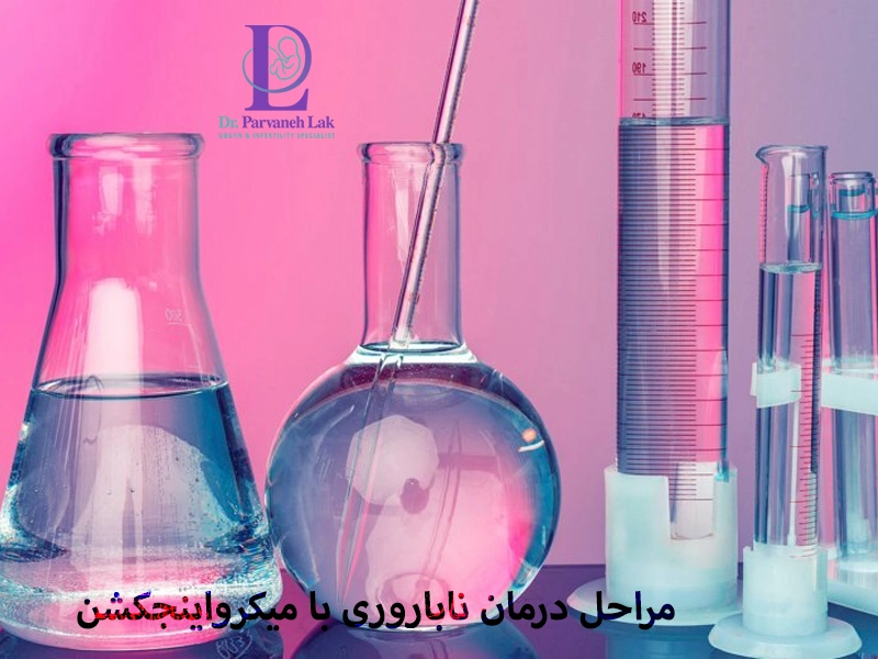 مراحل درمان ناباروری با میکرواینجکشن