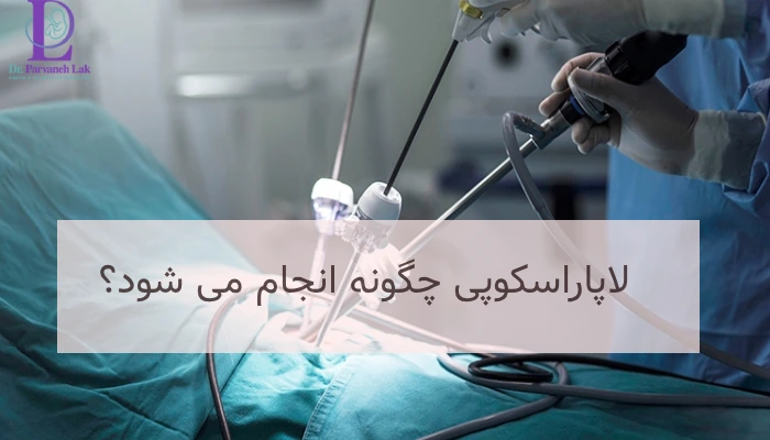 نحوه انجام لاپاراسکوپی