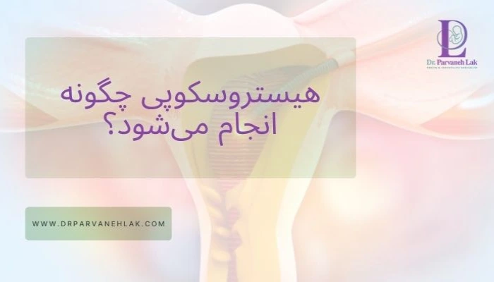 هیستروسکوپی چگونه انجام می شود؟
