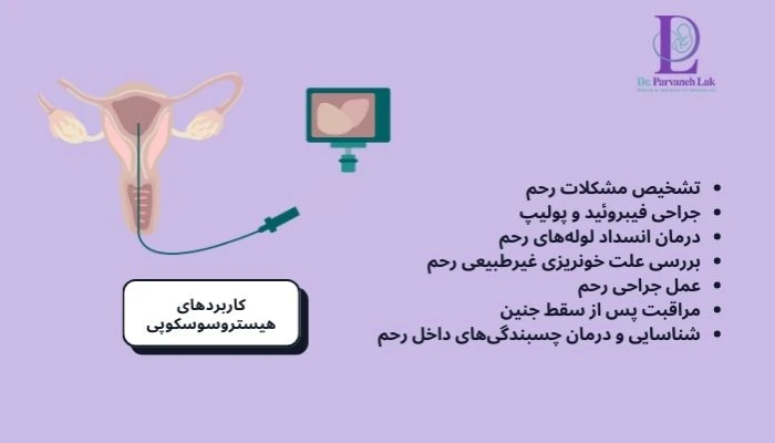 کاربردهای هیستروسکوپی