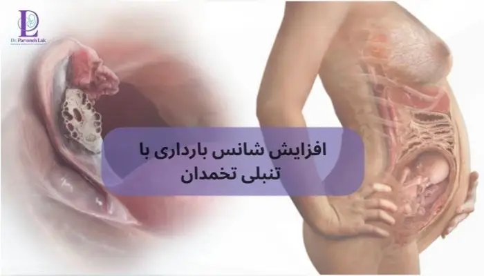 افزایش شانس بارداری با تنبلی تخمدان 