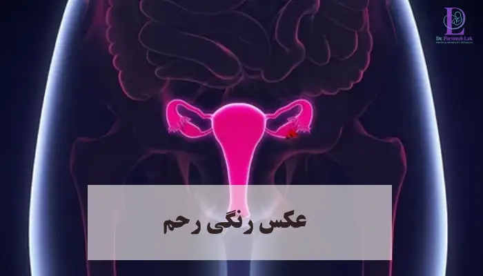 عکس رنگی رحم چیست؟ 