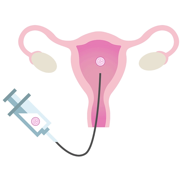  انتقال جنین