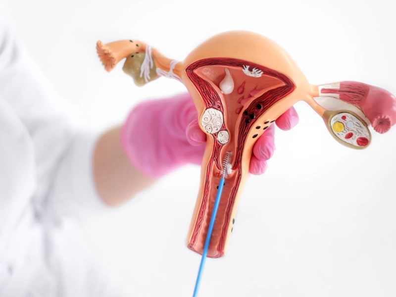 آیا هیستروسکوپی درد دارد؟